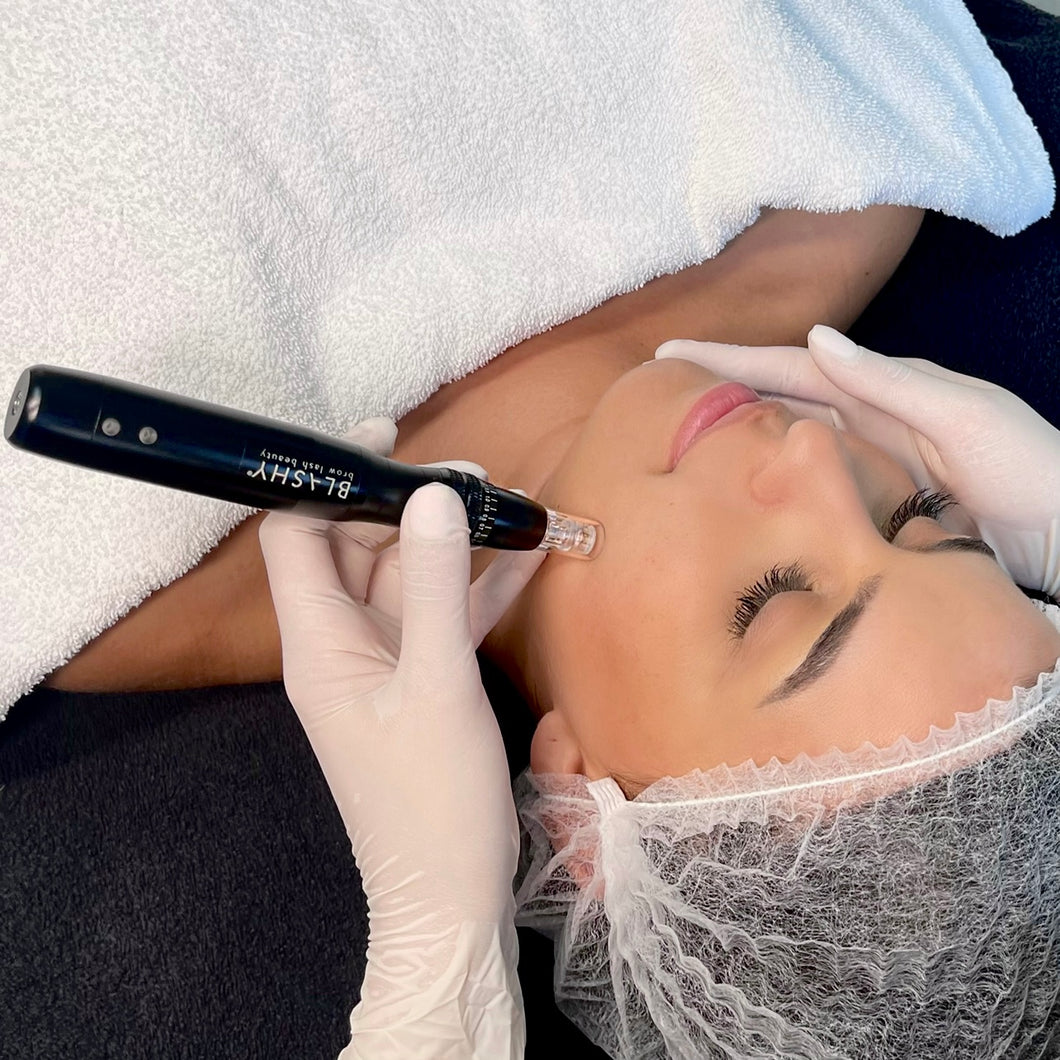 Microneedling